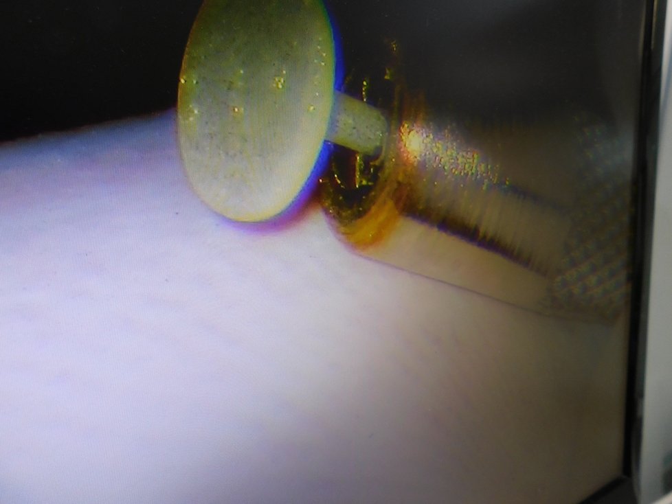 Výroba miniaturních ušních implantátů je pečlivá práce pod mikroskopem.
