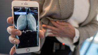 Koncepce českého e-zdravotnictví je hotová, lékařům se ale nelíbí Koncepce českého e-zdravotnictví je hotová, lékařům se ale nelíbí