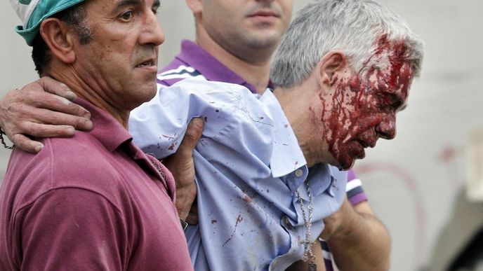 Strojvedoucí Francisco Garzón po nehodě Strojvedoucí Francisco Garzón po nehodě