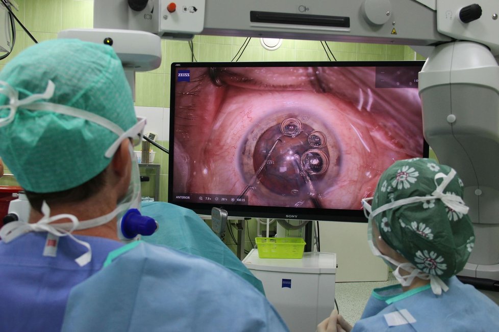 Nový 3D mikrokop umožňuje lékařům na očním oddělení lépe sledovat operace díky velkoplošnému zobrazení.