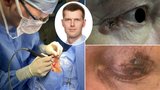 Ječné zrno u oka? Hrozí i nádor, varuje lékař a radí, jak jej rozpoznat
