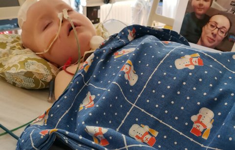 Adámek (3) bojuje o život! Ke covidu se přidal pneumokok a zápal plic