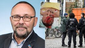 Policie vyšetřuje útok na poslance AfD, záběry z kamer jsou v rozporu s výpovědí napadeného. Po pachatelích se stále pátrá, (10.01.2019).