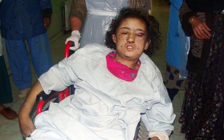 Sahar byla převezena do nemocnice a už se cítí lépe