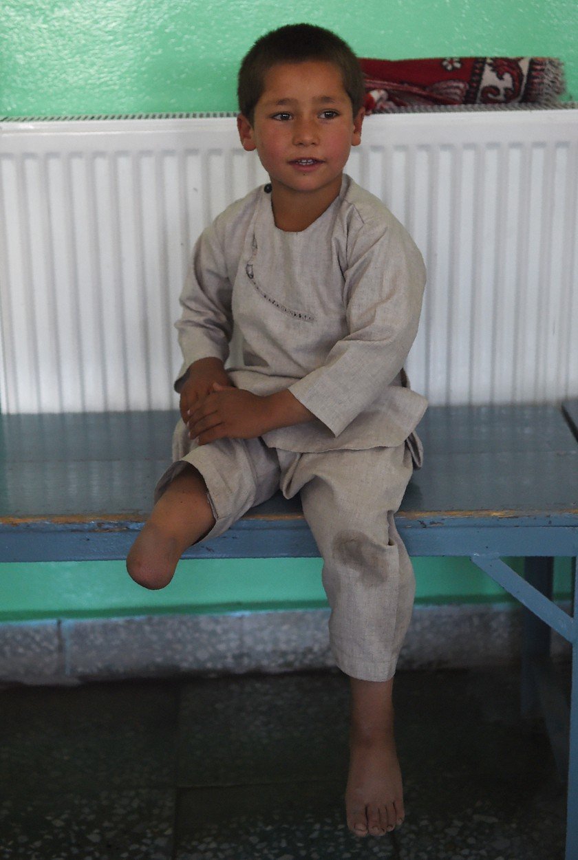 Pětiletý Afghánec svou novou protézu oslavil tancem.