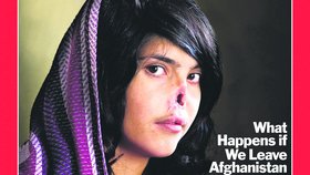 Zmrzačená Ajša (18) se nyní objevila na obálce amerického časopisu Times