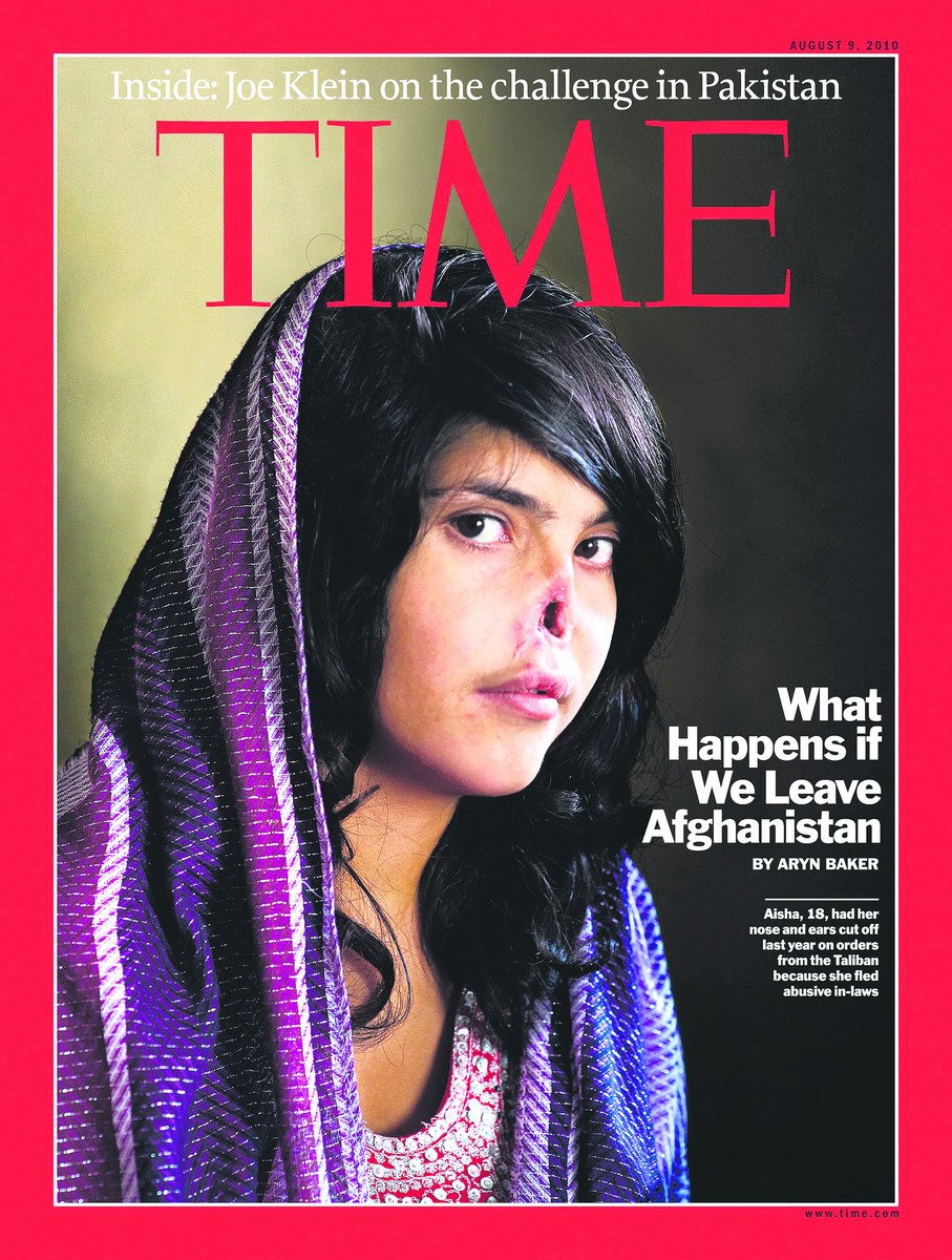 Zmrzačená Ajša (18) se nyní objevila na obálce amerického časopisu Times.