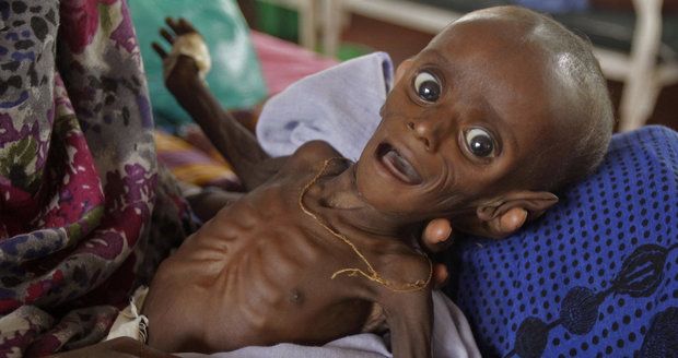 Kvůli suchu děti umírají hlady. Za měsíc jich v Etiopii zemřelo 70