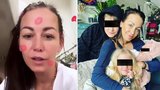 Strach Agáty Hanychové: Malou Rózu museli rozdýchávat!