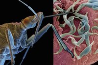 Ameriku děsí "nový AIDS": Šíří ho hmyz a může způsobit i výbuch srdce
