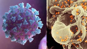 Lidé trpící HIV mají komplikovanější průběh covidu-19