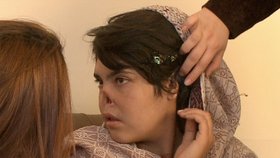 Afgánka Aisha (18): Manžel mi uřízl nos i uši!