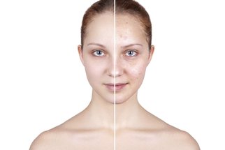 Akné, dermatitida a další: 6 problémů se kterými pomáhá dermokosmetika Akné, dermatitida a další: 6 problémů se kterými pomáhá dermokosmetika