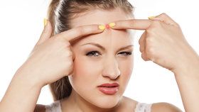 Problémy s trávením nebo se srdcem: Co na vás prozradí pupínky na obličeji?