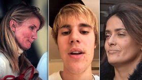 Akné trápí i slavné: Salmu Hayek, Cameron Diaz, Justina Biebera a další