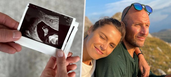 Aksel Lund Svindal a Amalie Iuelová očekávají narození potomka.
