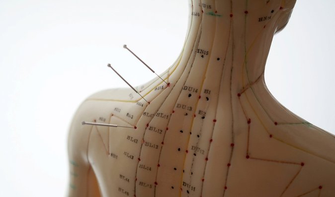 Akupunktura se využívá nejen k léčbě, ale také diagnostice a prevenci
