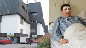 Jiří Štefl po útoku bezdomovce v supermarketu skončil s přeraženým nosem.