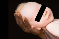 V Tanzanii zabili roční albínské batole. Na přípravu lektvaru štěstí