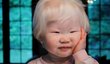 Albinismus: Co to je, proč vzniká a jak vypadá?