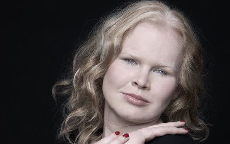 Diagnóza albinismu se potvrdila už v kojeneckém věku při očním vyšetření.