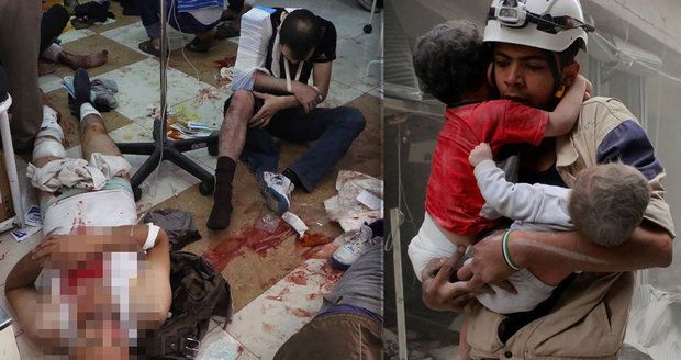 Apokalypsa v Aleppu: Místo operace amputace. Zásah do hlavy je rozsudek smrti