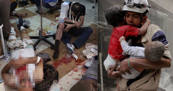 Lékaři jsou v Aleppu téměř bezmocní. Kvůli nedostatku krve nemohou některá poranění vůbec léčit.