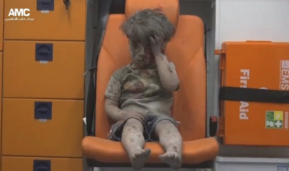 Během syrské války trpí i tisíce dětí. Fotky malého Umrána, vytaženého z trosek, obletěly svět.