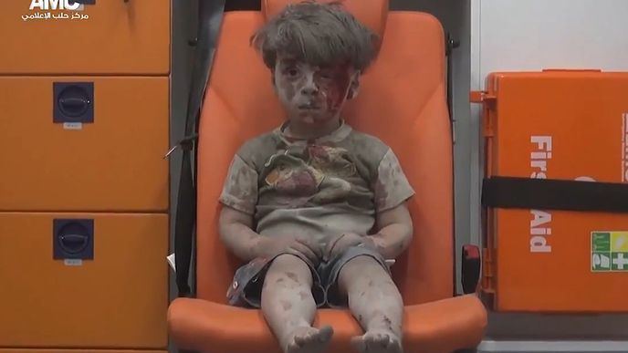 Zraněný pětiletý chlapeček v syrském Aleppu