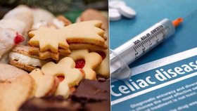 Stres, františky, cukroví i „chlupaté dárky“: Svátky jsou pro alergiky peklo