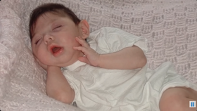 Alex se vzácným onemocněním, když byla miminko