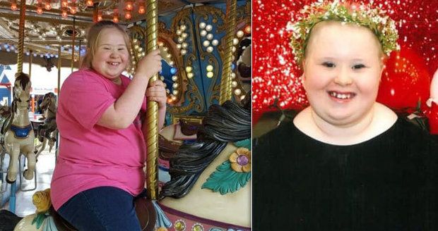 Dívka s Downovým syndromem přes rok bojovala s rakovinou: Nakonec podlehla covidu
