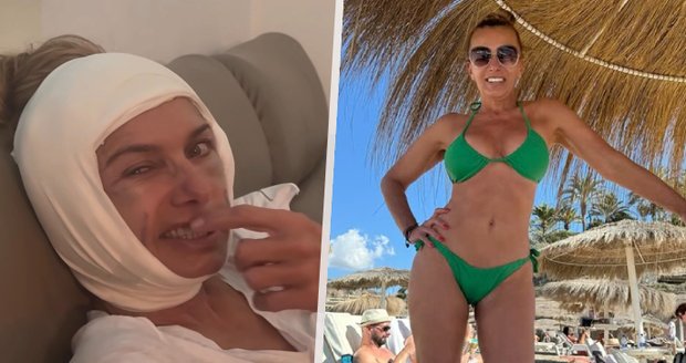 Bendová (52) po děsivém videu: Popsala detaily zákroku!