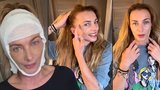 Alice Bendová 9 dnů po faceliftu: Jizvy kolem hlavy po odřezání dvou centimetrů kůže