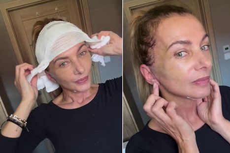 Obrázek: Alice Bendová po náročné operaci: Trhali ze mě kůži!