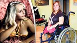 Alice (17): Nemám nohy, přesto chci být modelka!