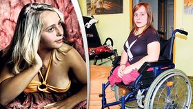 Alice (17): Nemám nohy, přesto chci být modelka!