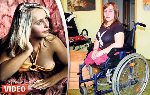 Alice (17): Nemám nohy, přesto chci být modelka!