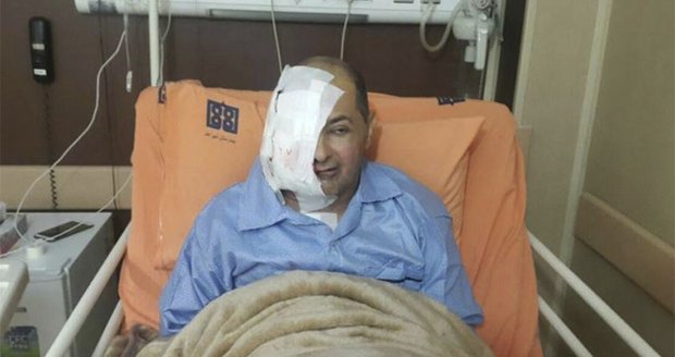Íránský novinář Alírezá Radžají přišel kvůli neléčené rakovině o oko a část obličeje.