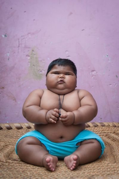 Indická holčička váží v 10 měsísích 20 kilo.