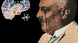 Alois Alzheimer objevil nemoc, která tehdy nikoho nezajímala. Dnes jí trpí 7 milionů lidí