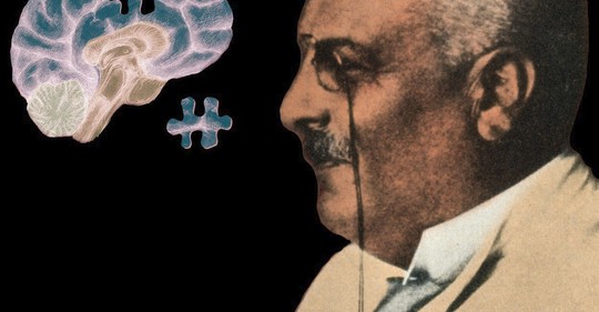 Alois Alzheimer: Bláznivý lékař s mikroskopem