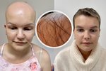 Katka bojovala s alopecií.  Po letech byla konečně u kadeřnice.