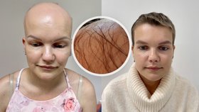 Katka bojovala s alopecií.  Po letech byla konečně u kadeřnice.