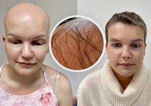 Katka bojovala s alopecií.  Po letech byla konečně u kadeřnice.