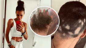 Vlaďka (43) přišla kvůli chorobě o vlasy, nechala si je vytetovat: Lekala se svého stínu!