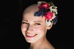 Blance kvůli alopecii vypadaly všechny vlasy, obočí i řasy. Nyní pomáhá jiným ženám, které mají stejný problém.