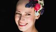 Blance kvůli alopecii vypadaly všechny vlasy, obočí i řasy. Nyní pomáhá jiným ženám, které mají stejný problém
