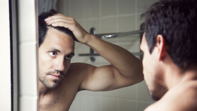 Alopecie u mužů má řešení v podobě transplantace Alopecie u mužů má řešení v podobě transplantace