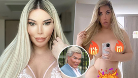 Ken a později Barbie Jessica Alvesová se nahá raduje z nové vaginy: Odpanění za půl milionu?! 